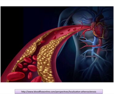 Taking Vitamin D and Calcium Without K2 Can Increase Heart Attack Risk