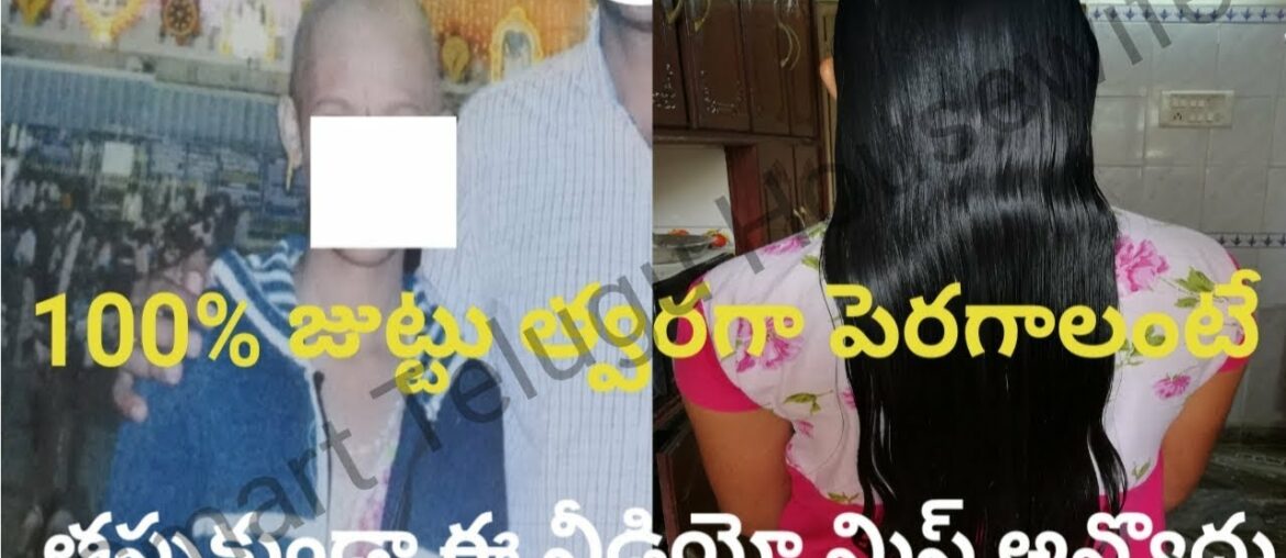 VITAMIN E HAIR OIL FOR EXTREME HAIR GROWTH IN TELUGU||GROW THICK HAIR FASTER #SMARTTELUGUHOUSEWIFE