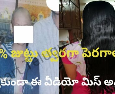 VITAMIN E HAIR OIL FOR EXTREME HAIR GROWTH IN TELUGU||GROW THICK HAIR FASTER #SMARTTELUGUHOUSEWIFE