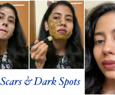 Remove Acne Scars, Dark Spots and Discoloration Naturally with this Routine