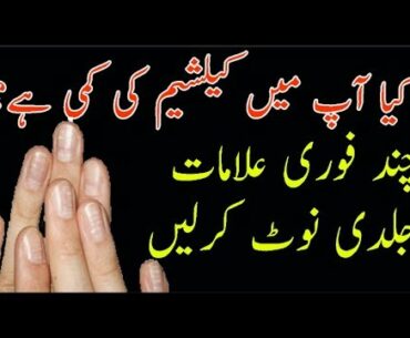 Calcium ki kami ki Alamat in urdu hindi|Calcium aur Vitamin D ka fori ilaj in Urdu Hindi