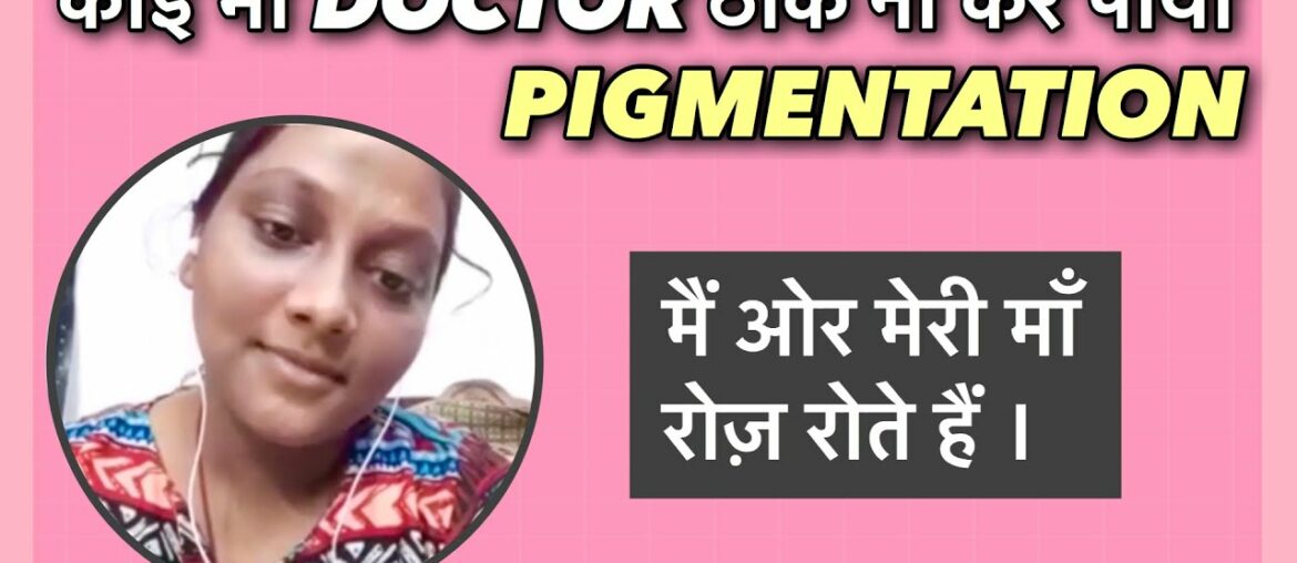 All Doctors failed to cure Pigmentation. Emotional story of my subscriber from Patna