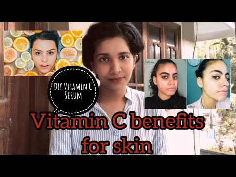 Vitamin C benefits for skin/Vitamin c foods and supplements /Vitamin C serum /DIY vitamin c serum