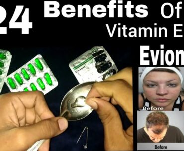 Evion 400 Vitamin E Capsule Benefits | How to Uses | Evion 400 for Skin & Hair Full Review In Hindi