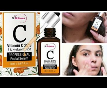 serum lagane ka sahi tarika|how to apply serum|stbotanica vitamin c serum|serum kaisey use kare