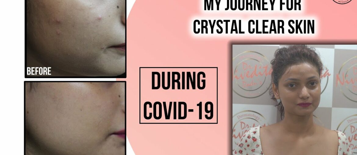 Our patient's journey who took Crystal Glaze treatment during COVID-19