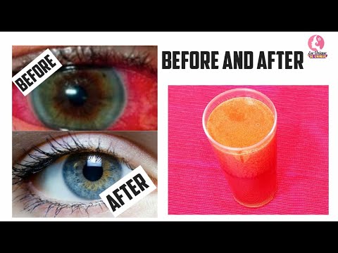 FORGET YOUR EYEGLASS AND USE THIS POWERFUL DRINK TREATMENT