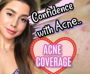 MY EVERYDAY FULL COVERAGE ACNE MAKEUP ROUTINE || Chit Chat Having Confidence with ACNE!!!!