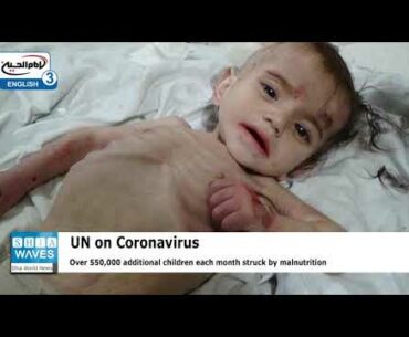 UN warns Coronavirus-linked malnutrition killing 10,000 children a month