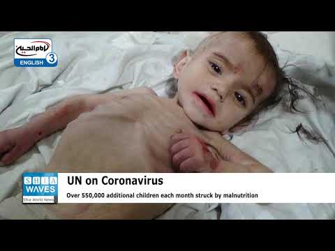 UN warns Coronavirus-linked malnutrition killing 10,000 children a month