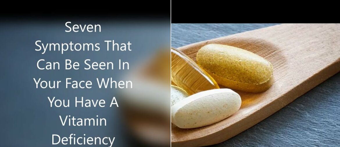 Seven  Symptoms Seen In Your Face When You Are Deficient In Vitamins