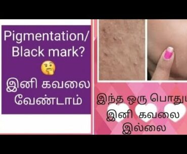 Pigmentation problem solve at home / black mark remove / which is beauty tech