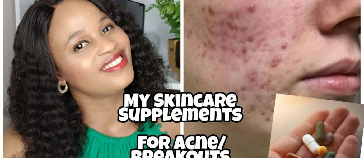 MY SKINCARE SUPPLEMENTS ROUTINE  FOR GLOWY SKIN/2020