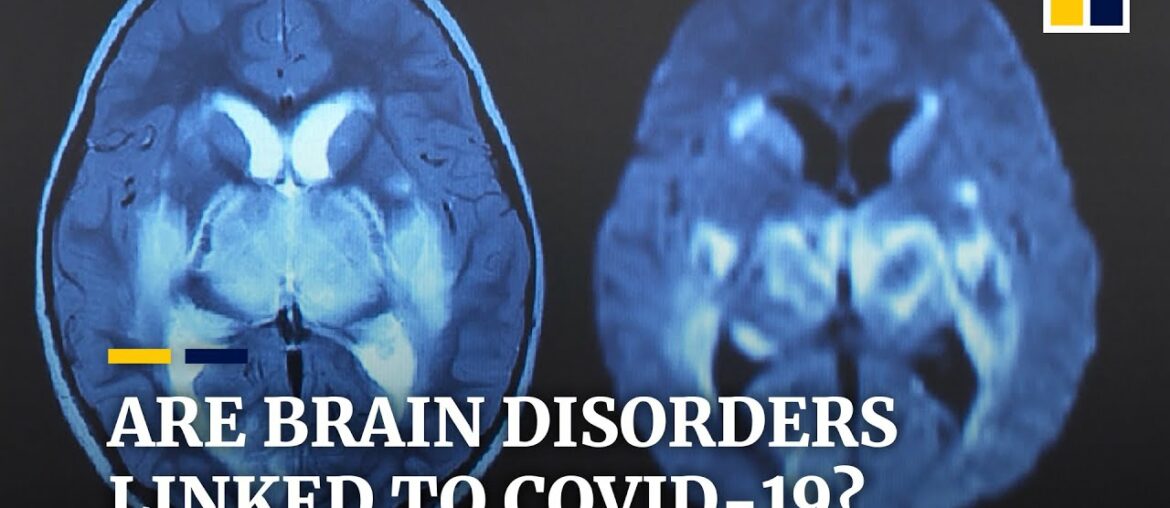 Links between brain disorders and coronavirus infections under investigation in the UK