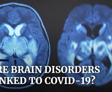 Links between brain disorders and coronavirus infections under investigation in the UK