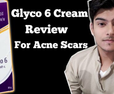 Glyco 6 Cream | glycolic acid | Remove pigmentation | Acne Scars | pimple marks| glycolic acid cream