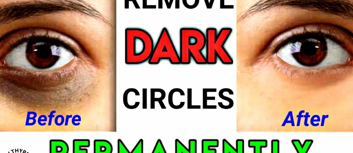 Remove Dark Circles Permanently | 100% working | Home Remedies