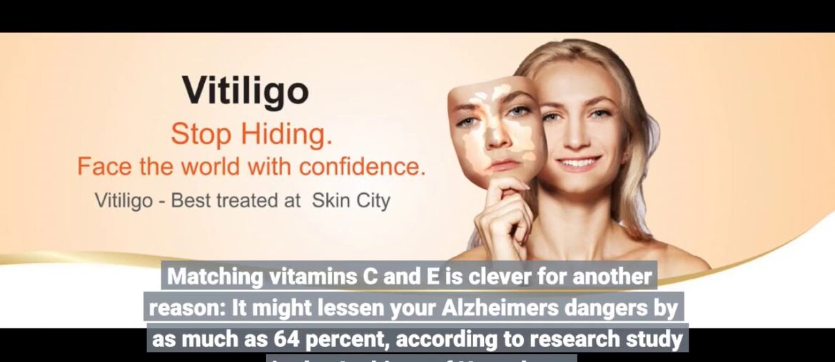 A Biased View of Skin Care ABC's: Vitamins A, C, and E - Siren Salon