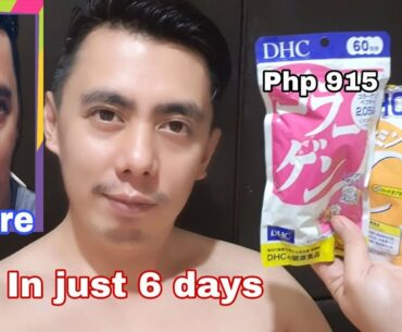 5 TIPS | HOW TO CORRECTLY USE DHC COLLAGEN & VITAMIN C BEST WHITENING, ANTI-ACNE TABLET | REVIEW