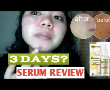 TANGGAL DARK SPOTS AT PIMPLE MARKS | GARNIER VITAMIN C SERUM REVIEW