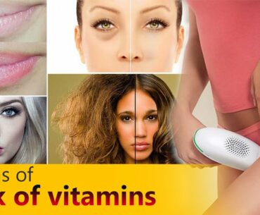 5 signs of lack of vitamins - Seekers Zone