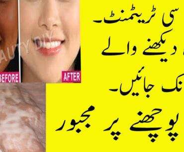 Skin Whitening Treatment | Vitamin C Whitening Treatment | Beauty Tips In Urdu | Noor Skin Care