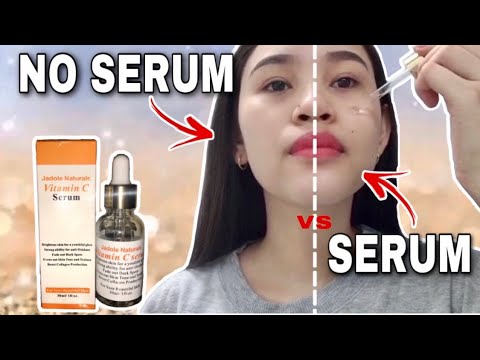 Jadole Naturals Vitamin C Serum Honest Review | Anti-Oxidant | Amazon #SkinCare #VitaminC #Natural