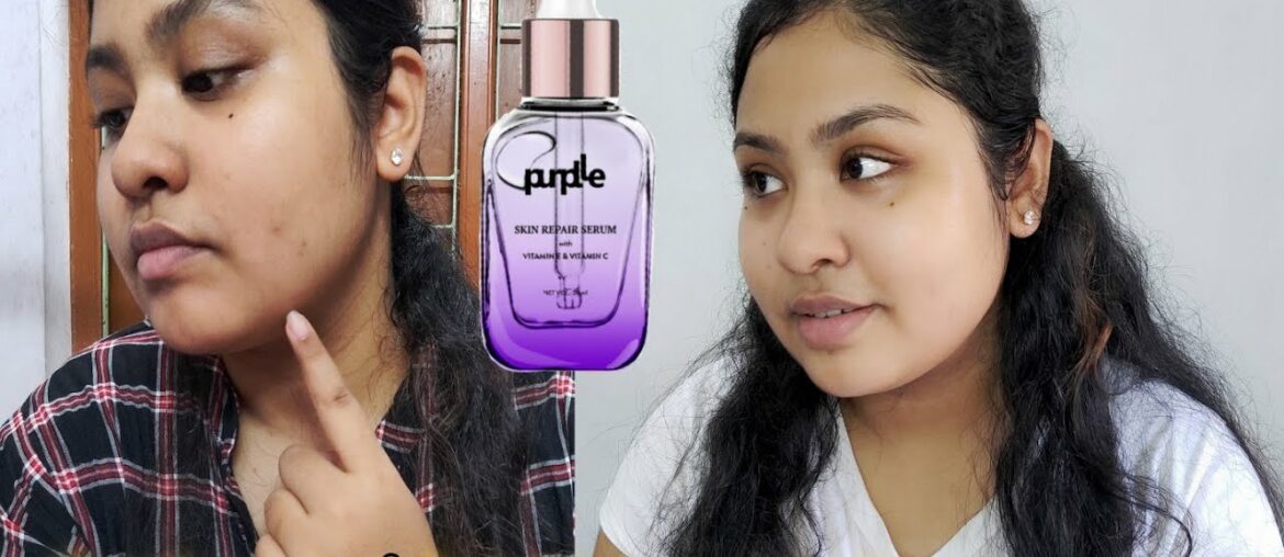 My thoughts about Purple skin repair serum with vitamin e & c . Best for pigmentation & blemishes??