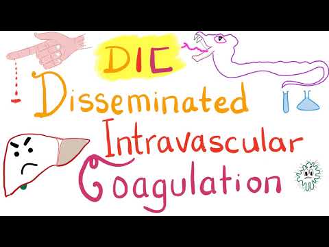 Disseminated Intravascular Coagulation (DIC)