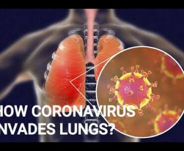 Coronavirus and covid 19 Pneumonia:How does the pneumonia  developes in a covid positive patient.