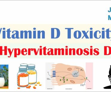 Vitamin D Toxicity (Hypervitaminosis D) | Causes, Pathophysiology, Symptoms, Diagnosis, Treatment