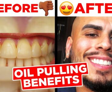 WHITEN YOUR TEETH FAST WITH OIL PULLING! #teethwhitening