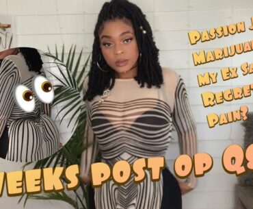 3 Weeks Post Op Q&A | 360 Lipo| BBL| Breast Augmentation|