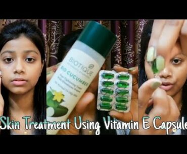 Skin Treatment Using "Vitamin E" Capsule || Night Skincare With Vitamin E || Saheli Das ||