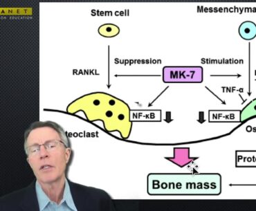 Vitamin K2, Osteocalcin dan Diabetes