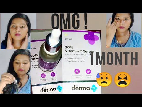 REVIEW OF DERMA CO VITAMIN C SERUM. I TRIED IT FOR 1 MONTH & THIS IS WHAT HAPPEN ON MY FACE!