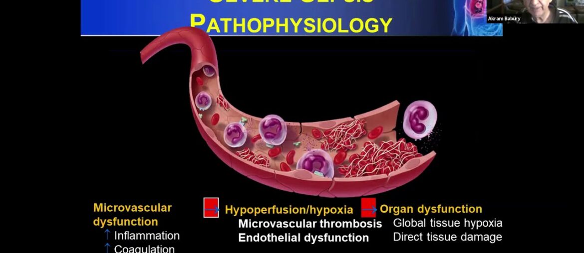 AMC Telemedicine - COVID 19 By Dr. Akram Baburi