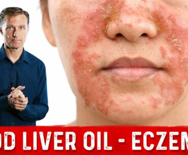 Why Use Cod Liver Oil for Eczema?