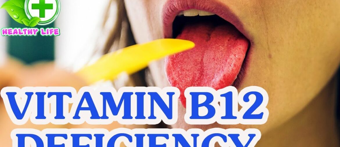 10 Signs That Speak Out Loud About Vitamin B12 Deficiency