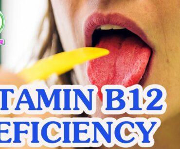 10 Signs That Speak Out Loud About Vitamin B12 Deficiency