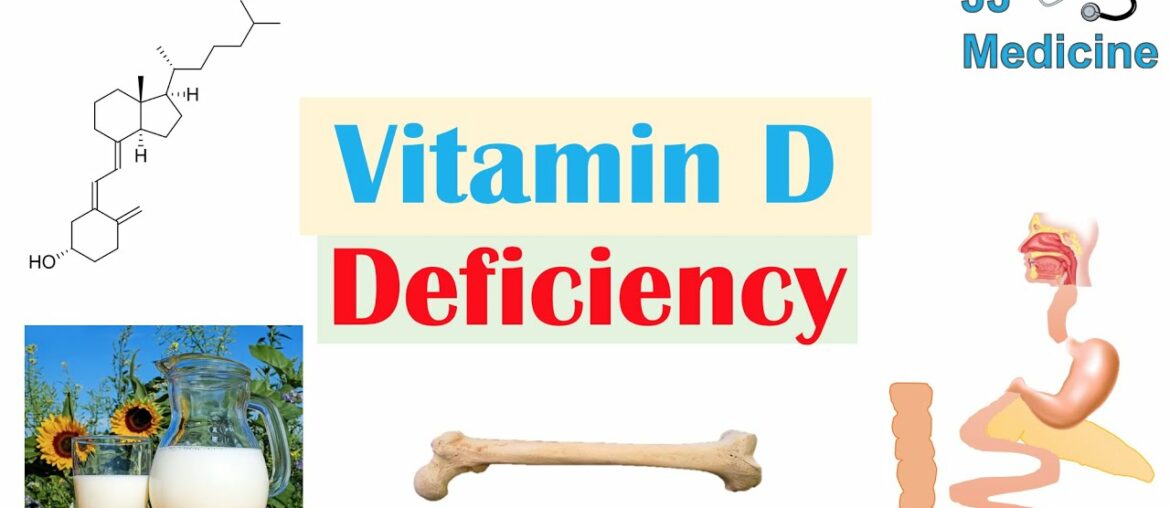 Vitamin D Deficiency | Introduction, Absorption & Metabolism, Purpose of Vit D, Causes of Deficiency