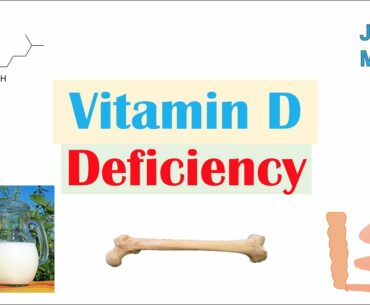 Vitamin D Deficiency | Introduction, Absorption & Metabolism, Purpose of Vit D, Causes of Deficiency