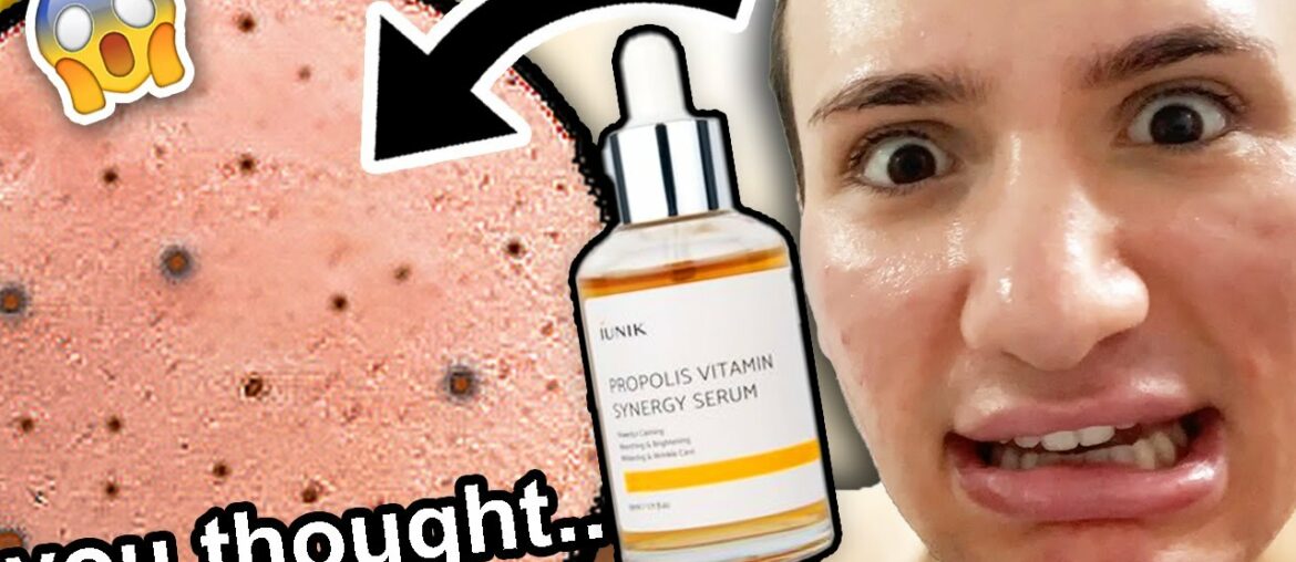 I tried iUNIK PROPOLIS SYNERGY SERUM for ONE WEEK!! (I have to laugh...)