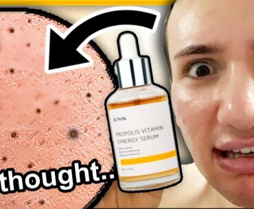 I tried iUNIK PROPOLIS SYNERGY SERUM for ONE WEEK!! (I have to laugh...)