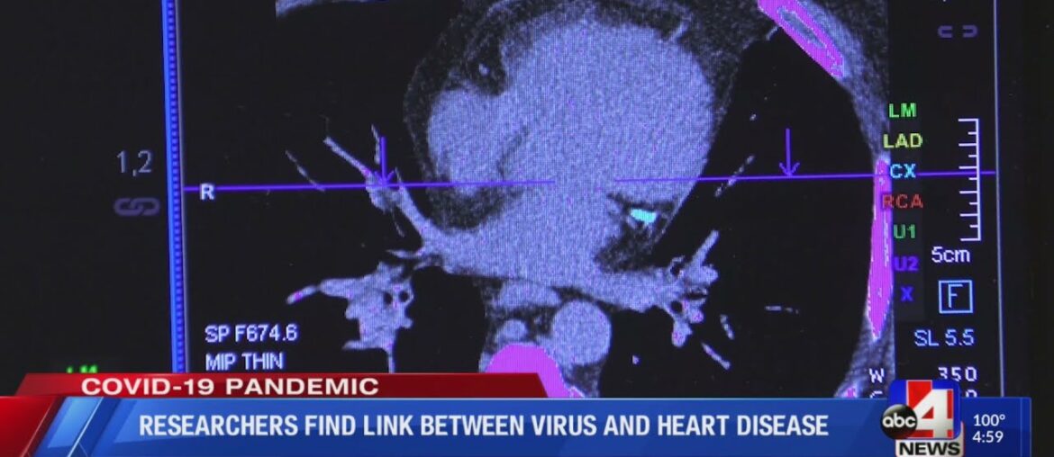 Intermountain Healthcare Researchers find link between COVID-19 and heart disease