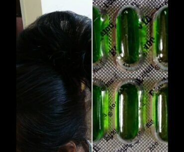 World's Best Hair Oil l Vitamin E Hair Growth Oil l Beauty Tips