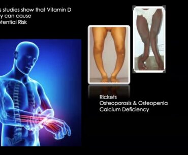 Live Vitamin D Lecture with Testimonials by Dr. Sheryl, ND