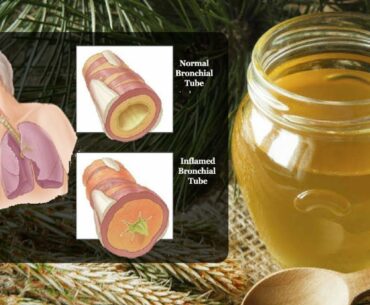 Syrup Of Pine Needles For A Strong Immune System And Healthy Lungs