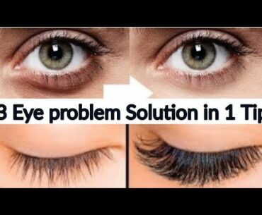 Dark Circles, Wrinkles & Eye lashes growth Solution In 1 Video | Real Beauty Secrets In Urdu & Hindi
