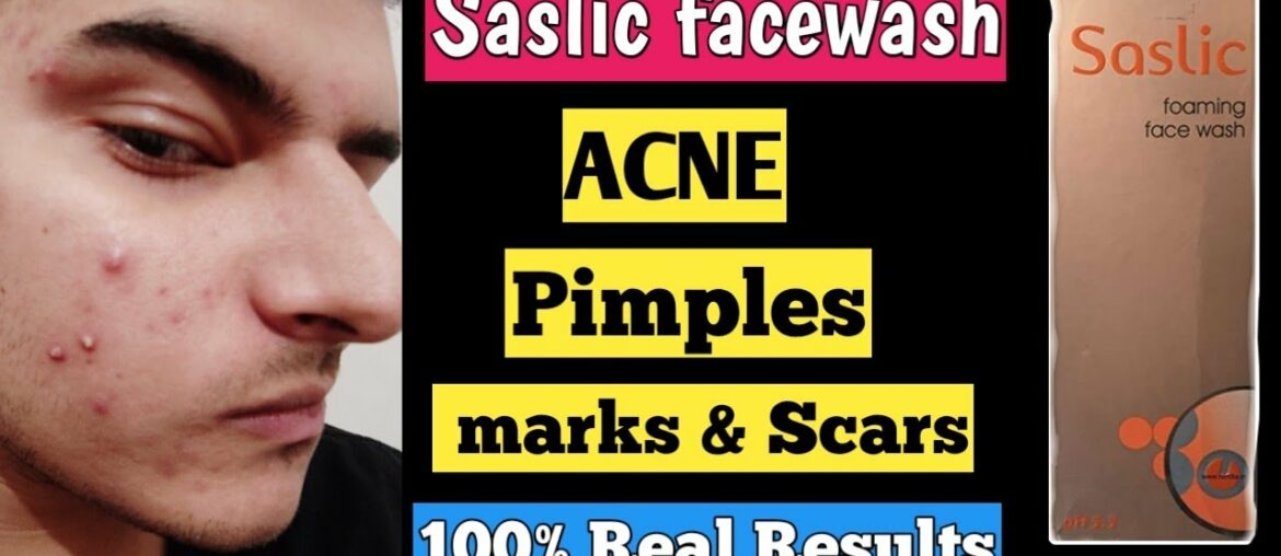 saslic face wash | saslic ds face wash review | salicylic acid facewash | saslic foaming face wash |